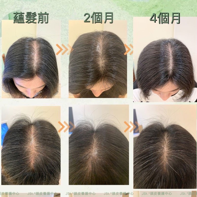 蘊髮